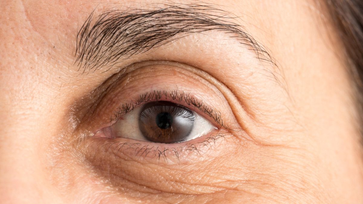 Penyebab Mata Tua sebelum Usia 40 Tahun