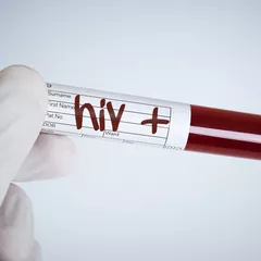 Hasil Tes HIV Reaktif (Positif), Ini 10 Hal yang Harus Kamu Lakukan