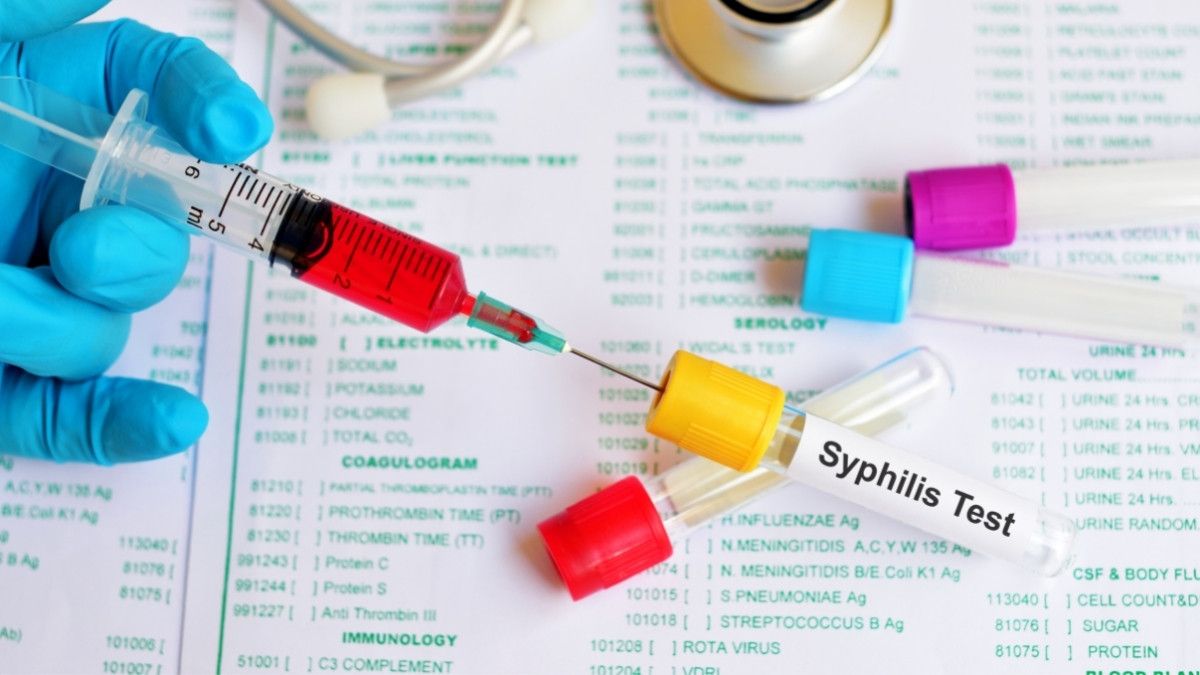 Mengenal Jenis dan Prosedur Pemeriksaan Sifilis