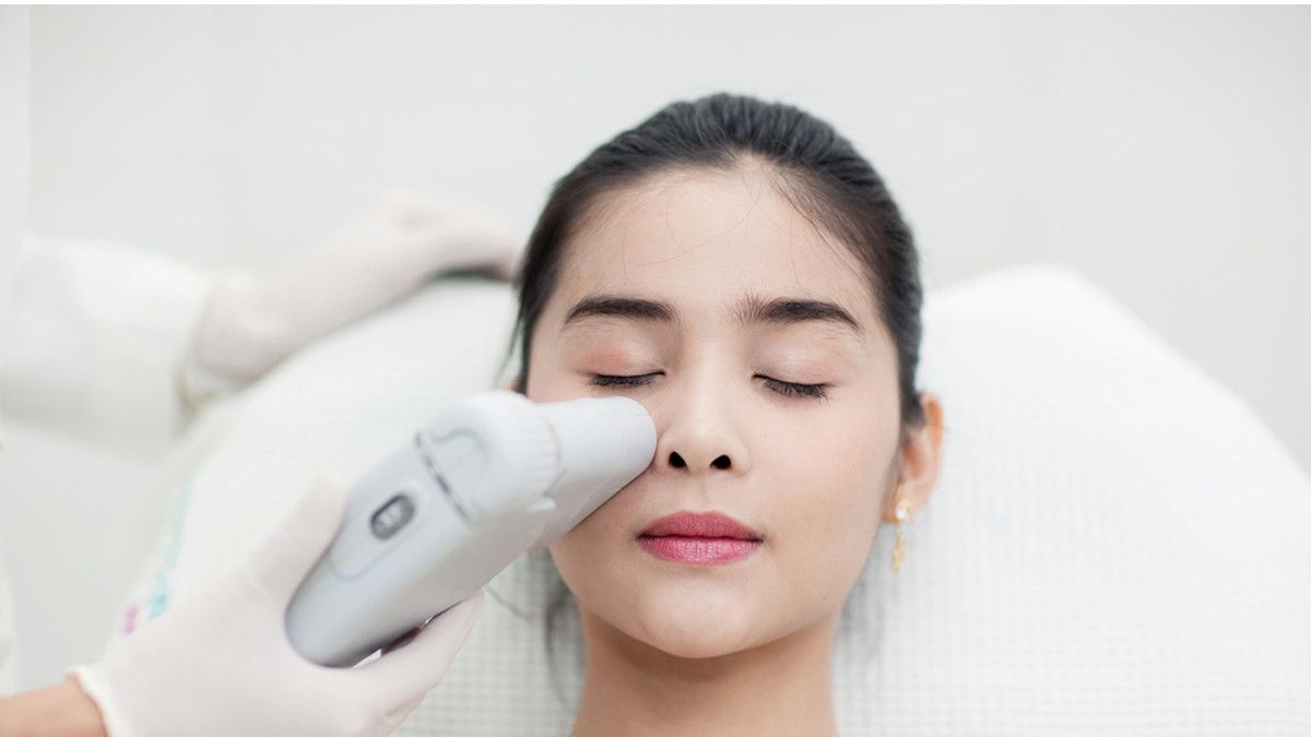 Ilustrasi Menggunakan Laser untuk Mengatasi Milia