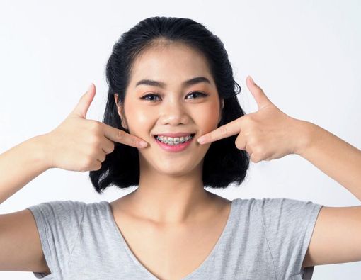 10 Kondisi Gigi yang Perlu Pakai Behel, Apa Saja?