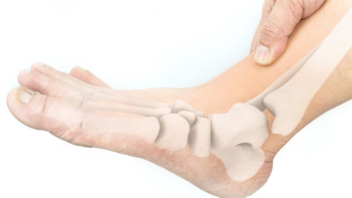 Cara Menyembuhkan Kaki X yang Bisa Anda Coba di Rumah