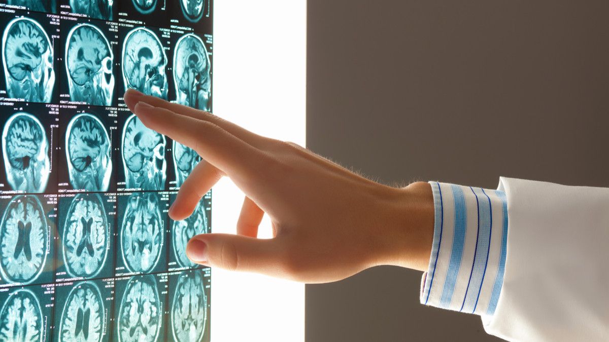 Ketahui Penyebab Penuaan Beserta Gangguannya