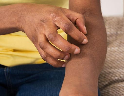 Perbedaan Rasa Gatal karena Diabetes dan Penyakit Kulit