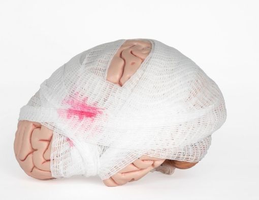 Kenali Neurosifilis, Komplikasi Sifilis yang Serang Otak dan Kepribadian