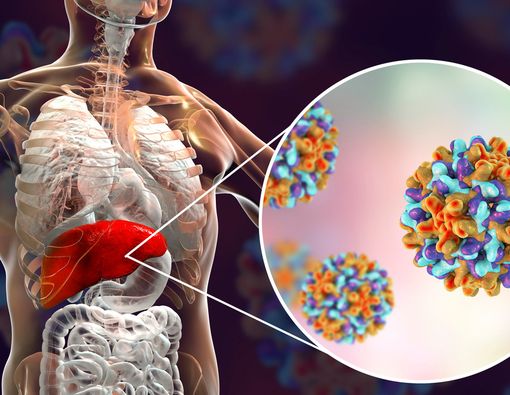 Hal-hal tentang Hepatitis yang Anda Perlu Tahu
