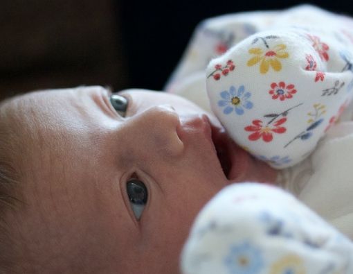 Sindrom CHARGE, Bentuk Mata Bayi seperti Mata Kucing