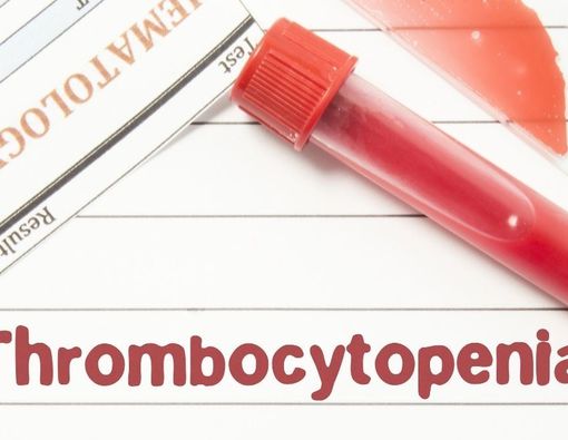 Trombositopenia