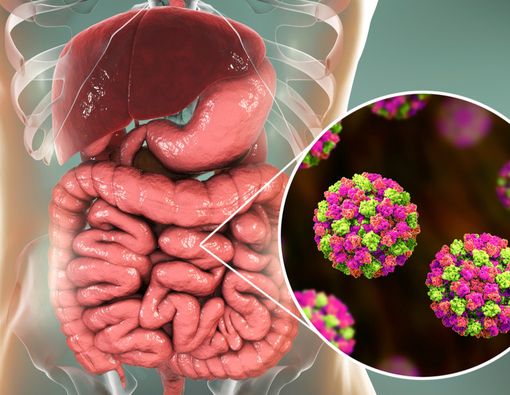 Penyakit akibat Norovirus, Benarkah Bukan Diare Biasa?