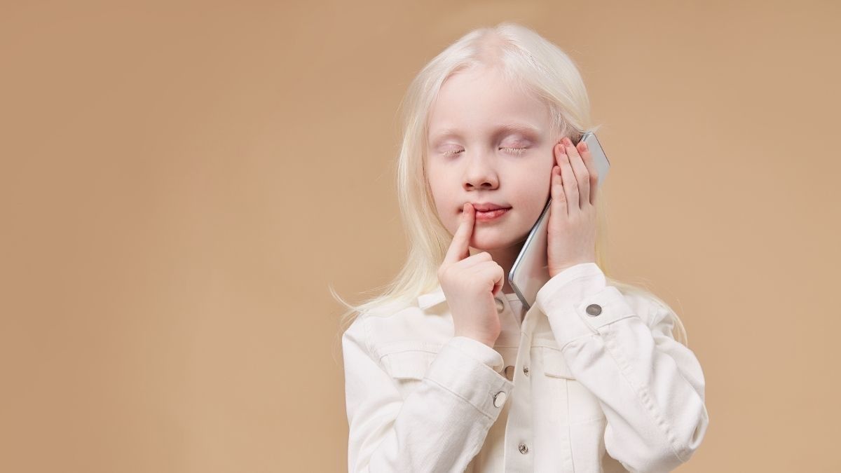 Waspadai Komplikasi yang Dapat Terjadi pada Anak Albino