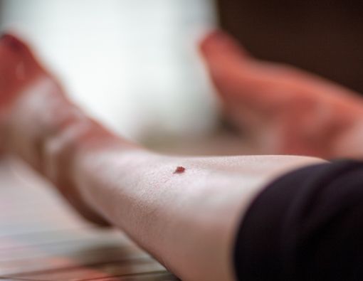 Mengenal Fungsi Tulang Kering yang Jarang Diketahui