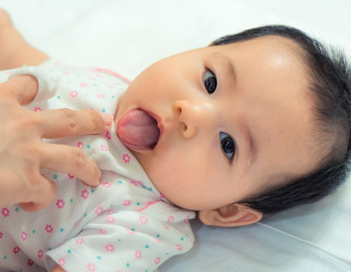 Orang Tua Wajib Tahu, Ini  Cara Deteksi Tongue-tie pada Bayi