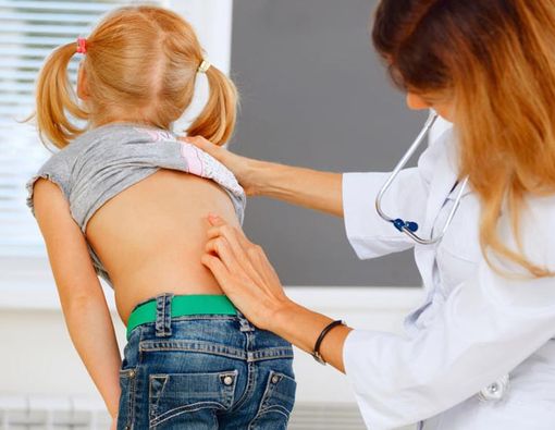 Inilah Penyebab Osteoporosis pada Usia Muda