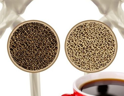 Kebanyakan Kopi Bisa Bikin Tulang Keropos!