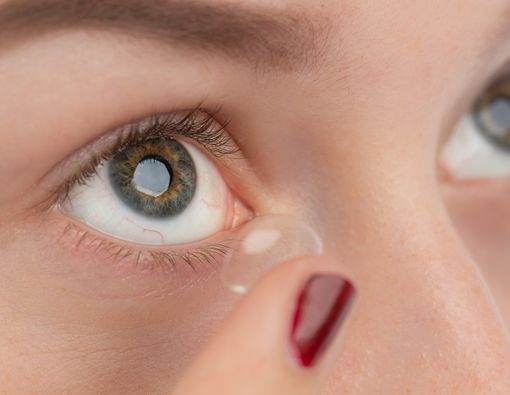 Pakai Lensa Kontak Abal-abal, Apa Efeknya pada Mata?
