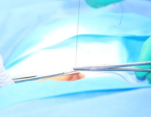 Cara Merawat Luka Jahitan di Vagina agar Cepat Kering