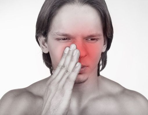 Berhenti Menyalahkan Sinus, Coba Cek Hidung Anda!