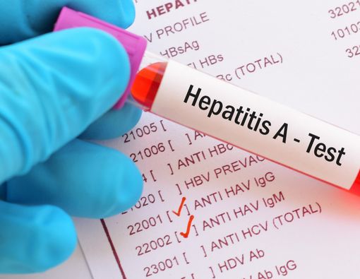 Tanda-Tanda dan Cara Mengatasi Hepatitis A pada Anak