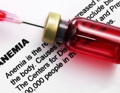 Anemia Bisa Jadi Gejala Kanker Usus Besar, Kok Bisa?