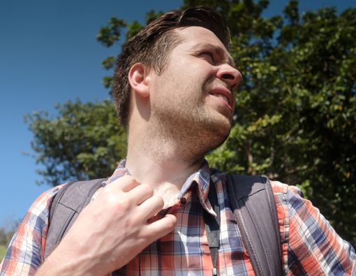 Waspadai Serangan Heatstroke di Musim Kemarau