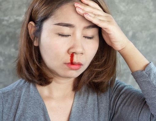 Hati-Hati, Ini Ciri Mimisan yang Berbahaya