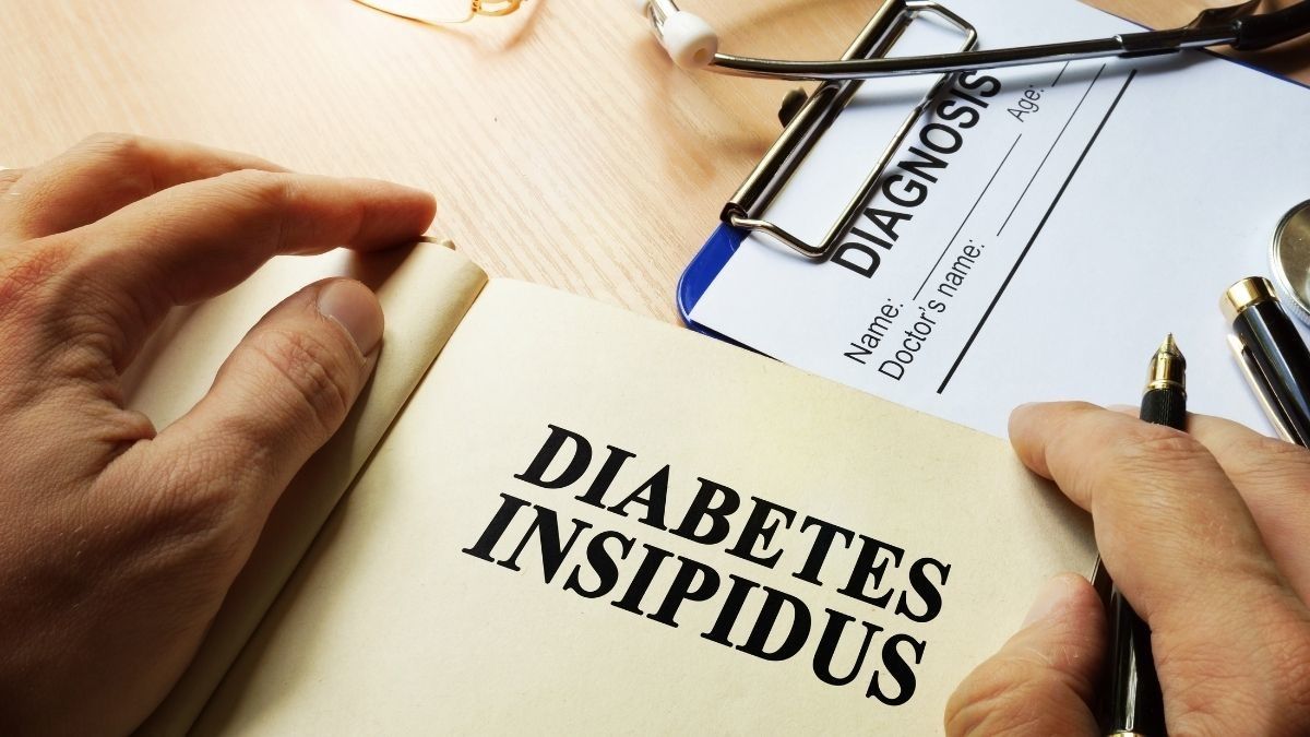 Cara Mendiagnosis Diabetes Insipidus