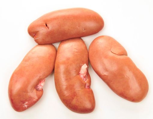 Mengungkap Prosedur Cangkok Ginjal Babi untuk Manusia