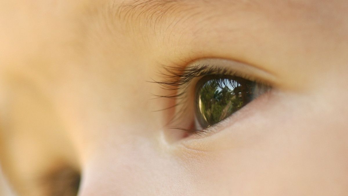 Memahami Katarak Kongenital pada Bayi Baru Lahir