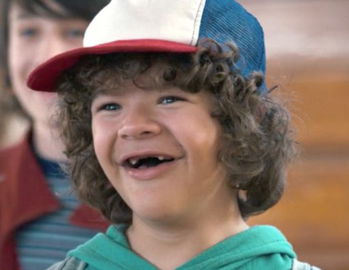 Gigi Tidak Tumbuh meski Sudah Besar? Kenali Kondisi Hypodontia