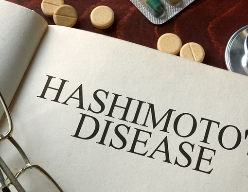 Tanda-Tanda Penyakit Hashimoto yang Perlu Anda Tahu