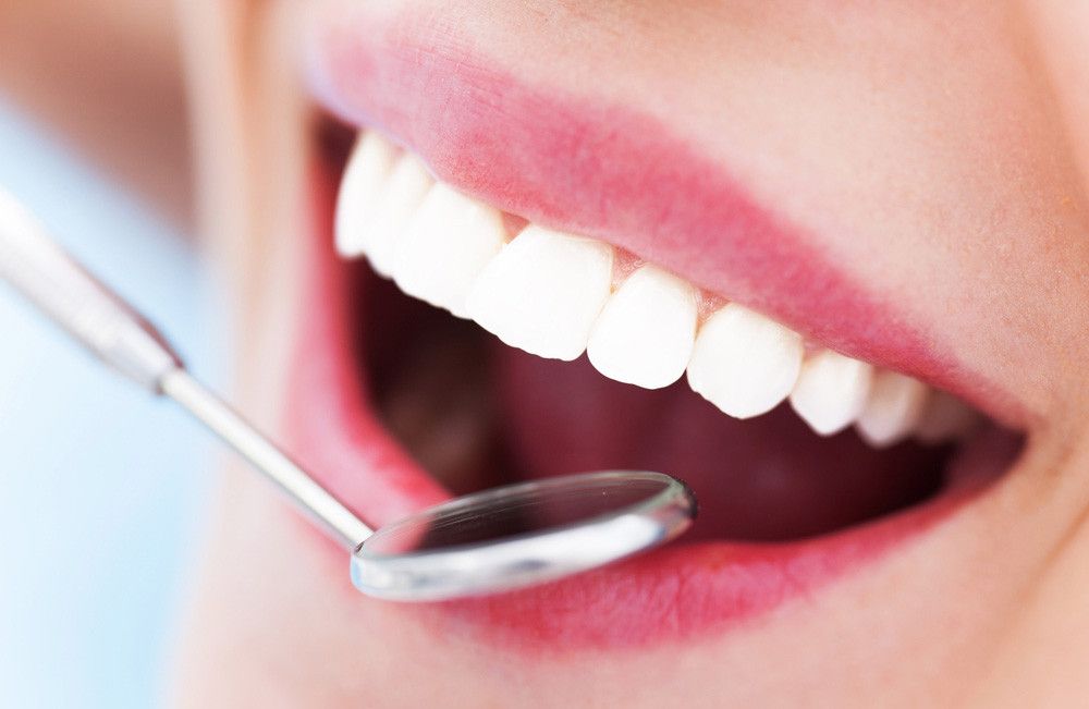 7 Mitos Kesehatan Gigi yang Boleh Anda Abaikan