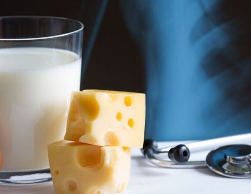 Konsumsi Susu Bisa Lawan Osteoporosis, Mitos atau Fakta?