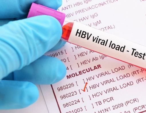 Mengenal Tes Viral Load untuk Mendeteksi Hepatitis C