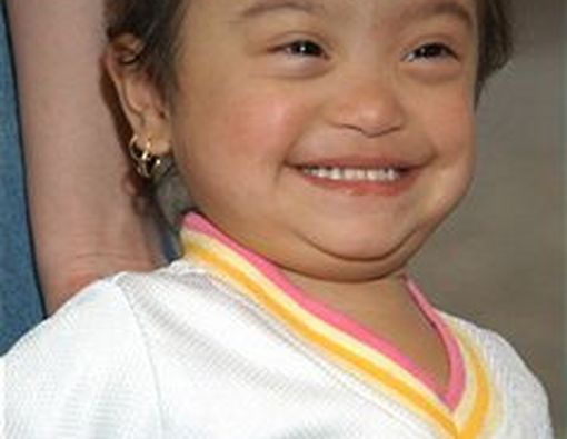 Lingkungan Berperan Penting Dalam Perkembangan Autis