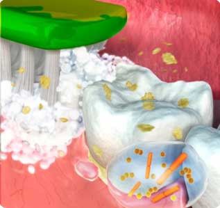 Bersihkan Sisa Makanan Sebaik-baiknya