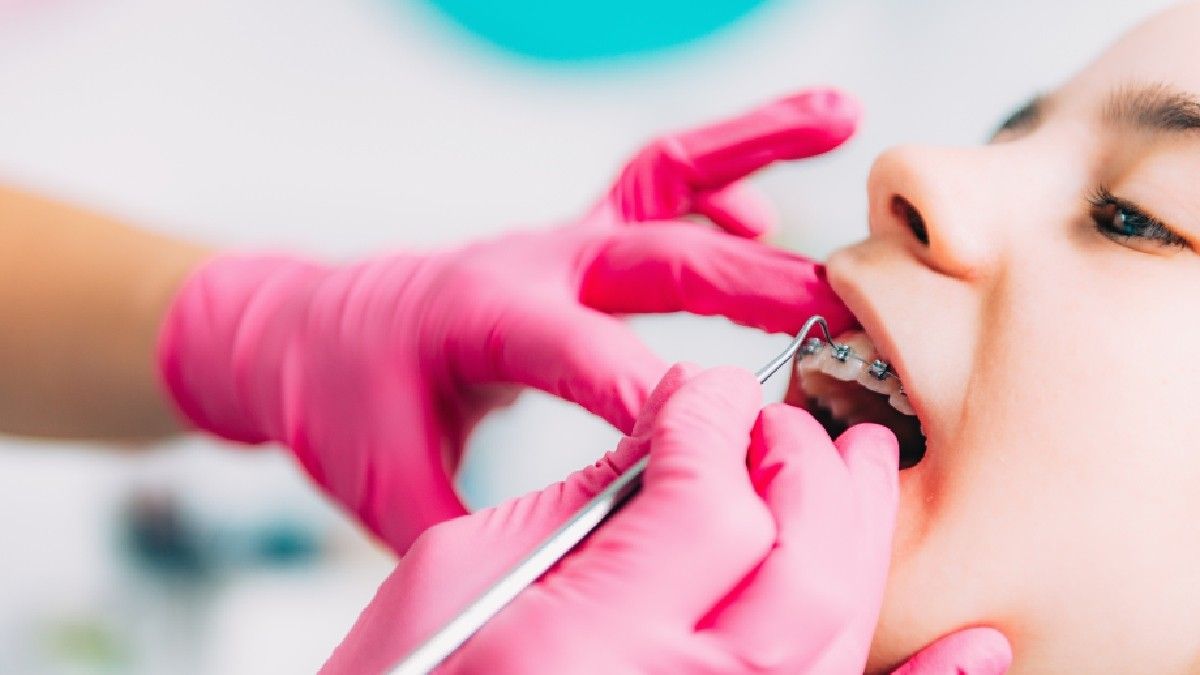 Perawatan Behel yang Terlalu Lama Bikin Gigi Ngilu?