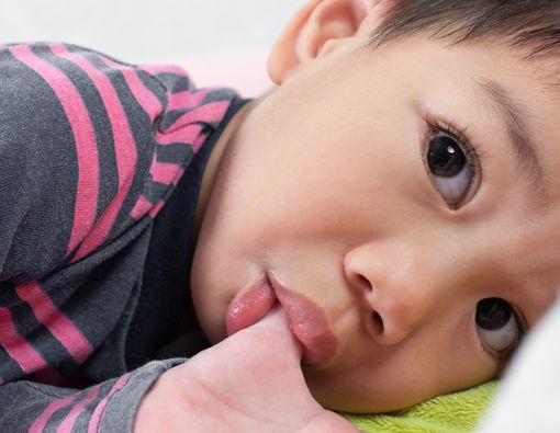 Kebiasaan Hisap Jempol si Buah Hati dan Dampaknya terhadap Gigi