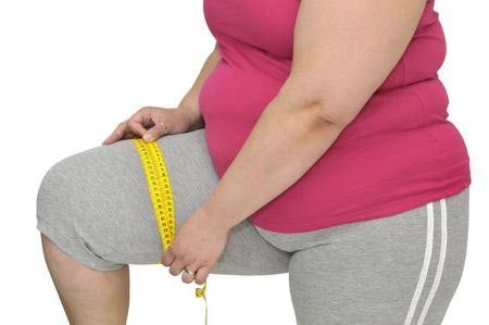 Mengapa Bisa Terjadi Obesitas?