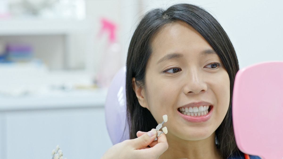 3 Ciri Veneer Gigi Gagal yang Harus Kamu Tahu