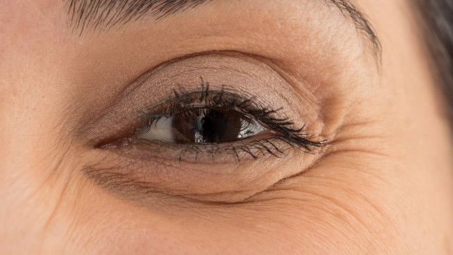Cara Mudah Hilangkan Kerutan di Ujung Mata
