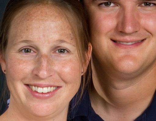 4 Penyebab Flek Hitam yang Tidak Anda Sadari