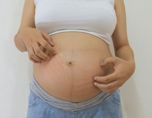 Jangan Anggap Remeh Gatal di Selangkangan Saat Hamil!