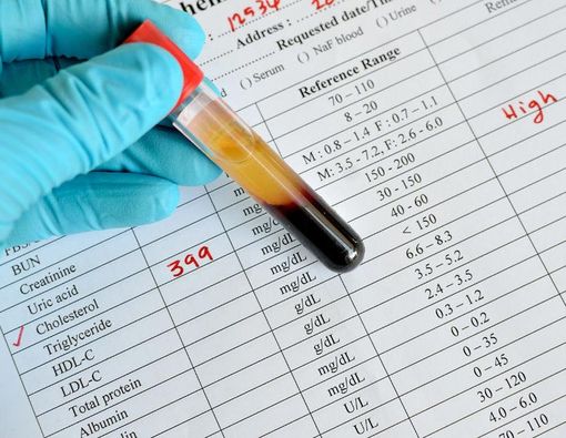 Tingkatan Kolesterol di Dalam Darah