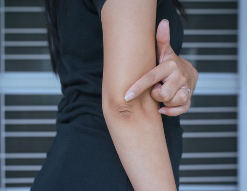 Penyebab Benjolan pada Siku