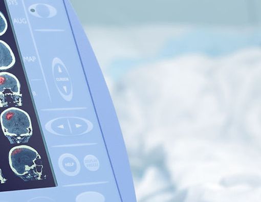 Mengenali Ciri-ciri Kondisi Mati Otak