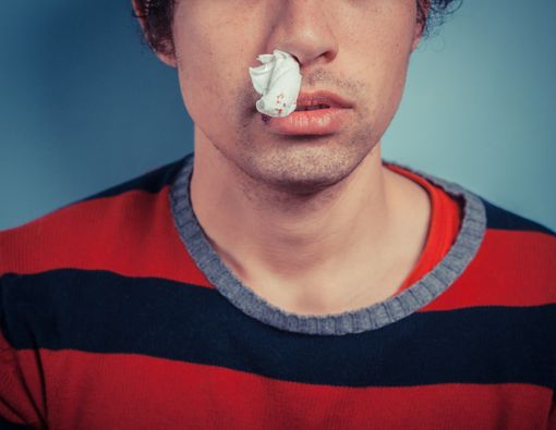 5 Alasan Mengapa Anda Mengalami Mimisan