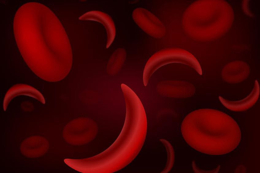 Penyakit Sickle Cell Anemia, Apa Itu?