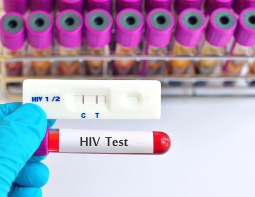 Waktu Tepat Tes HIV Setelah Berhubungan Tanpa Pelindung