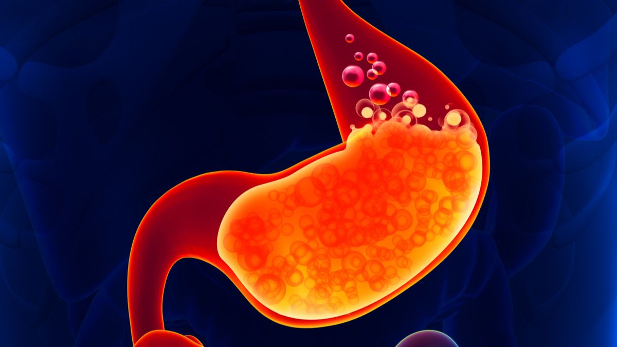 Penyebab Asam Lambung Sering Kambuh (Foto: Shutterstock)