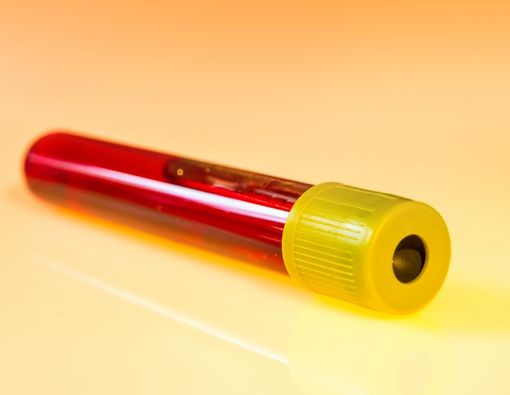 Alasan Pentingnya Puasa Sebelum Cek Darah